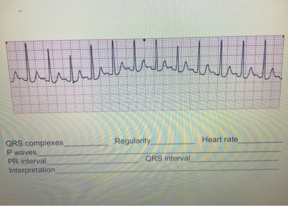 Regularity Heart rate QRS complexes P waves PR interval Interpretation QRS interval