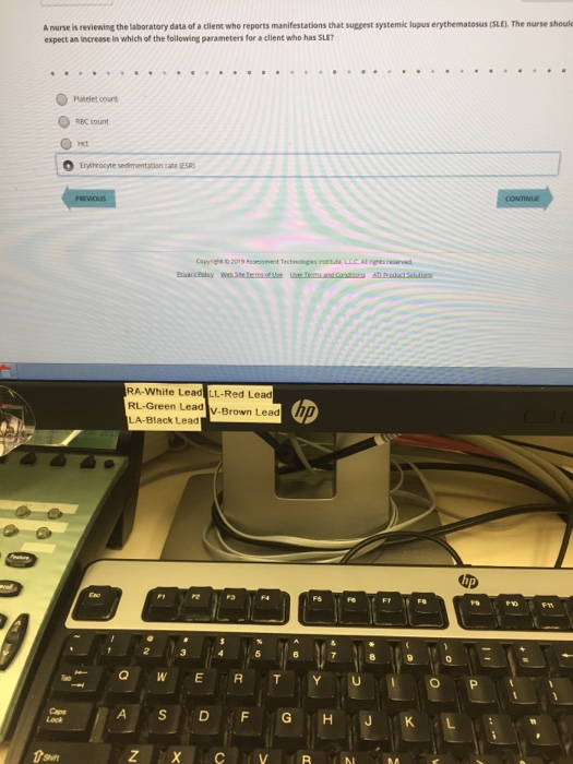 A nurse is reviewing the laboratory data of a client who reports manifestations that suggest systemic lupus erythematosus (SL