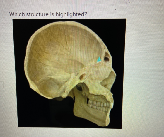 Which structure is highlighted? ON