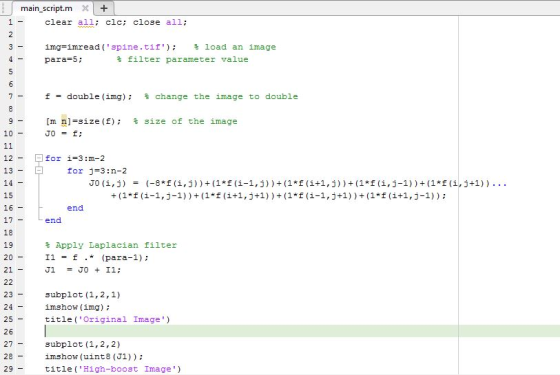 main-script·m + clear all clc: close all: img-imre ad ( ·spine. tif ) ; para 5: load an image filter parameter value f = double (img); % change the image to double [m -JO=f; n]=size (f); size of the image for i=3 : m-2 13 14 15 16 - 17 18 19 20 21 for i-3:n-2 J0 (i,j) (-8*f (1,j))+(1*t(1-1,j) ) + (1*t(1+1 , j )) + (1*t(1,J-1))+(1*t(1,jt1 ) ) = end end Apply Laplacian filter 11-f .* (para-1); JI -JO + 11; 23 24 25 26 27 28 29 subplot (1,2,1) imshow (img); title (Original Image) subplot (1,2,2) imshow (uint8 (J1)) title High-boost Image)