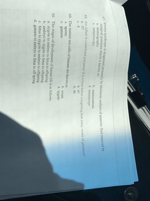 surgical puncture which oskd prenatlly by aboratory analysis of amniotic fhuid removed by a. amniography c. amnioscopy 47 Down syndrome is diagnosed b. amniocentesis d. amnioscope An infant is considered premature if it is borm before completing how m many weeks of gestation? a. 37 b. 47 d, 40 The mature sex cells of humans are known as: a. sperm c. gamete 49. b. ovum d. zygote The stages of development of human life is as follows: a. zygote to embryo to fetus to offspring b. embryo to zygote to fetus to offspring c. fetus to zygote to embryo to offspring d. gamete to embryo to fetus to off spring 50.