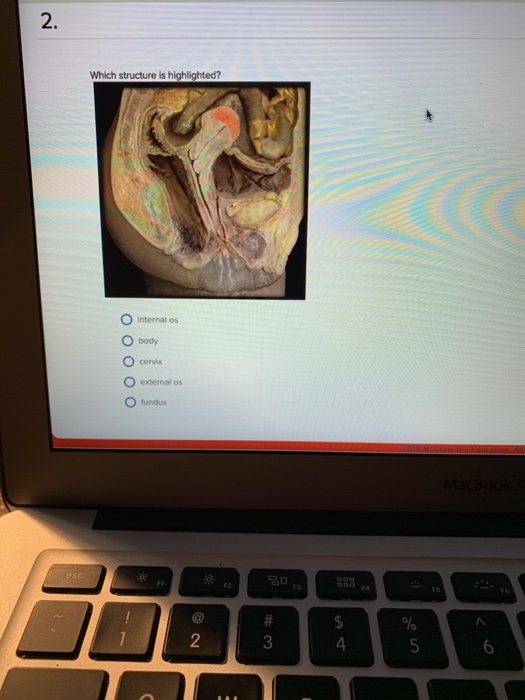 2. Which structure is highlighted? Internal os O body cervix extemal os fundus 19 McGeain is daiselcon A MacBoo esc FI F2 F4