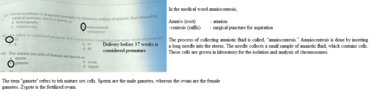 In the medical word amniocentesis Down syndrome is diagnosed prenatally by laboratory analysis of surgical puncture which is known as: amniotic fluid removed Amni o (root) - amion -centesis (suffix) - surgical puncture for aspiration The process of collecting amniotic fluid is called, amniocentesis. Amniocentesis is done by inserting These cells are grown in laboratory for the isolation and analysis of chromosomes. c. amnioscopy amnioscope infant is considered premature if it is born before com 37 leting how many weeks of b. 4 before 3/ weeks iS a long needle into the uterus. The needle collects a small sample of amniotic fluid, which contains cells. a d, 40 considered premature e mature sex cells of humans are known as: a. sperm 49. Th b. ovum d. zygote gamete The term gamete refers to teh mature sex cells. Sperm are the male gametes, whereas the ovum are the female gametes. Zygote is the fertilized ovum.