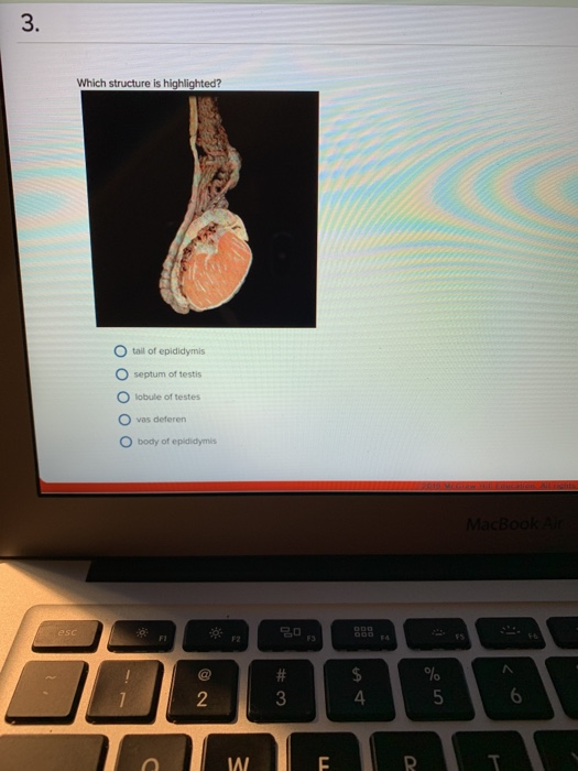 3. Which structure is highlighted? tail of epididymis O septum of testis Olobule of testes vas deferen body of epididymis Ma