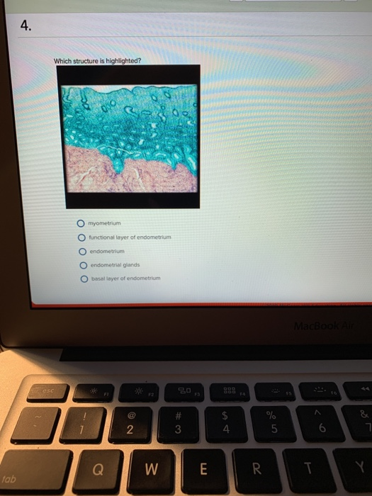 4. Which structure is highlighted? O myometrium O functional layer of endometrium O endometrium O endometrial glands basal la
