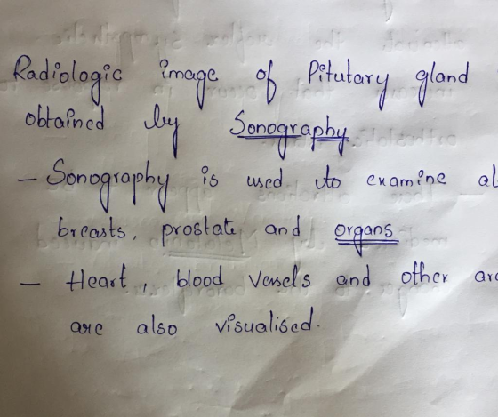 2010 Tul uned NOONG Radiologic amage of Pitutary gland obtained by Sonography centro - Sonography is used to examine al breas