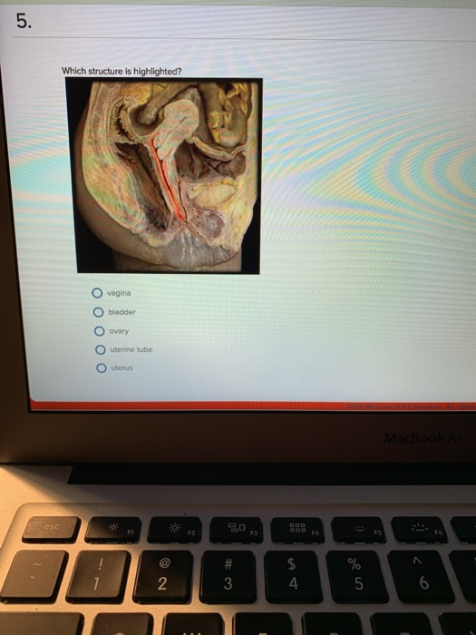 5. Which structure is highlighted? vagina O bladder O ovary uterine tube O uterus MacBook Air esc FI F2 F3 EA # $ 2 3 6 4 5 u