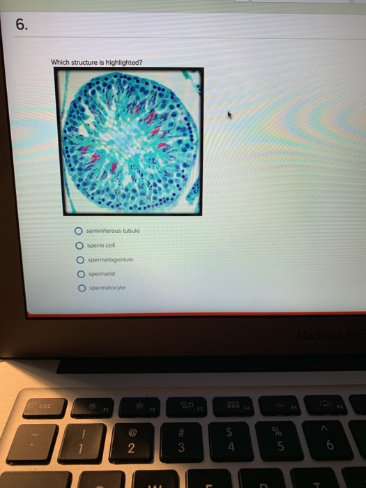 6. Which structure is highlighted? seminiferous tubule sperm cell O spermatogonium O spermatid O spermatocyte esc FI F2 FS #