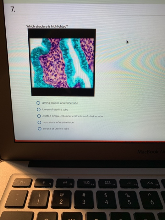 7. Which structure is highlighted? lamina propria of uterine tube lumen of uterine tube ciliated simple columnar epithelium o