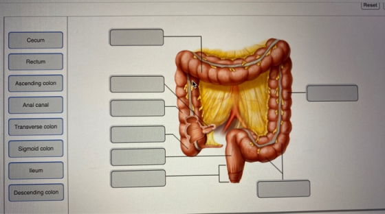 Reset Cecum Rectum Ascending colon Anal canal Transverse colon Sigmoid colon lleum Descending colon