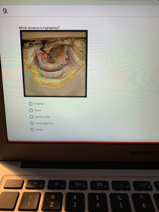 9. Which structure is highlighted? fimbriae ovary O uterine tube O round ligament uterus MacBook Ar esc FT F2 F3 FA FS F6 @ #