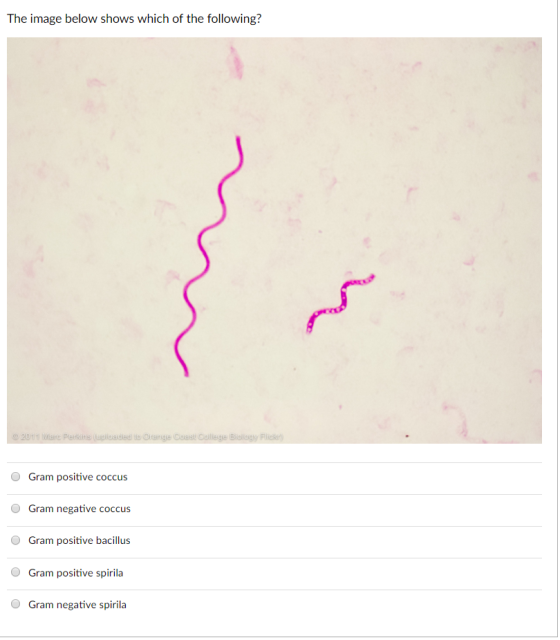 The image below shows which of the following? O Gram positive coccus O Gram negative coccus O Gram positive bacillus Gram positive spirila O Gram negative spirila