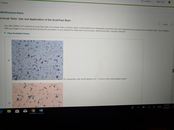 Hi, LaurenSign OutA Home AB-Structural Stains croLab Tutor: Use and Application of the Acid-Fast Stain K2 of 3 You INCORRECTLY perform an acid-fast stain on a smear from a mixed culture of Mycobacterium that you forget to use acid-alcohol during the procedure If you viewed this slide with a microscope smegmatis (acid-fast cells) and Staphylococcus aureus (non-acid-fast cells) Your mistake is what would each cell type look like? View Available Hint(s) M smegmatis cells would appear red S aureus cells would appear purple 756 PM 1/26/2019