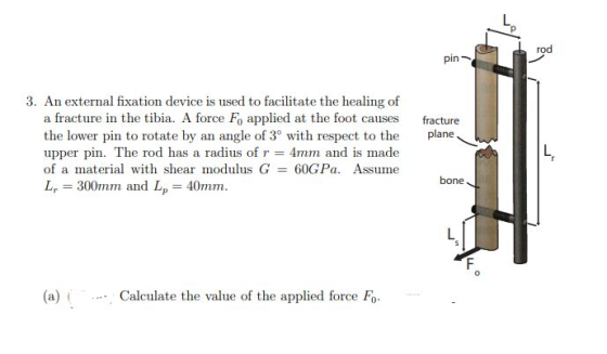 fracture plane 3. An external fixation device is used to facilitate the healing of a fracture in the tibia. A force Fo applie