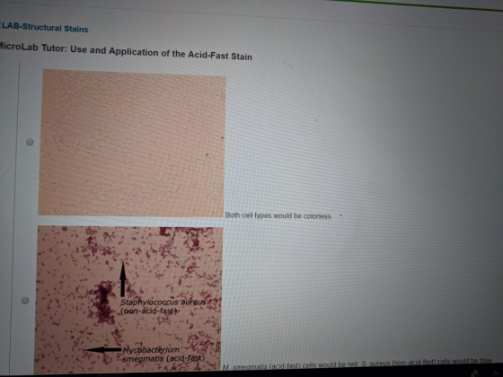LAB-Structural Stains MicroLab Tutor: Use and Application of the Acid-Fast Stain Both cell types would be colorless. Staphylococcus aureus (non-acid-fasty Mycobactêerióm smegmatis (acid-fast).