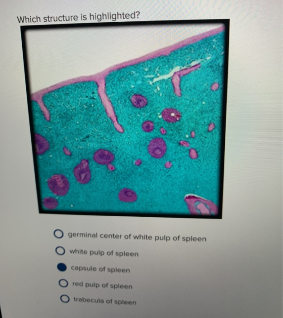 Which structure is highlighted? germinal center of white pulp of spleen O wh white pulp of spleen capsule of spleen O red pul