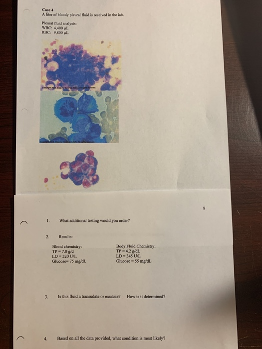 Case A liter of bloody pleural fluid is received in the lab. Pleural fluid analysis WRC: 4.400 ul. RBC: 9,800 L 1. What addit