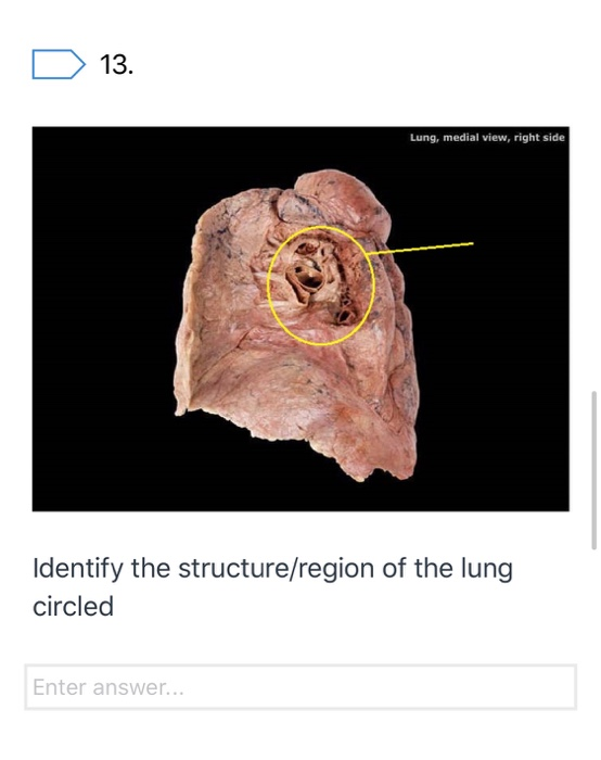 D 13. Lung, medial view, right side Identify the structure/region of the lung circled Enter answer...