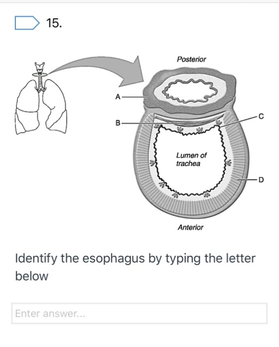 Posterior Lumen of trachea Anterior Identify the esophagus by typing the letter below Enter answer...