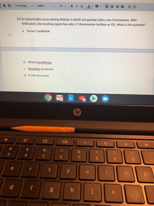 Qa List Parag.... Calibri . 12. BIV A A EEEEEE 24) An abnormality occurs during Meiosis in which one gamete lacks a sex chrom