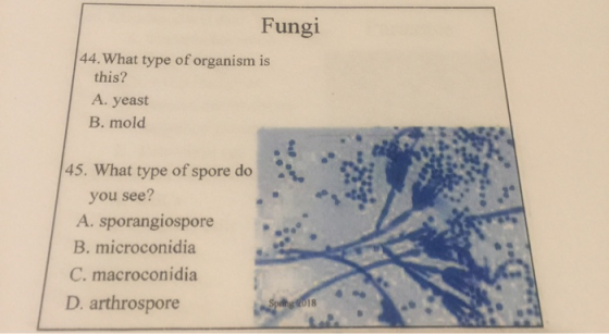 Fungi 44. What type of organism is this? A. yeast B. mold 45. What type of spore do you see? A. sporangiospore B. microconidi