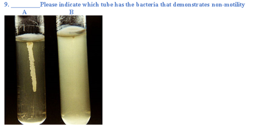 Please indicate which tube has the bacteria that demonstrates non-motility