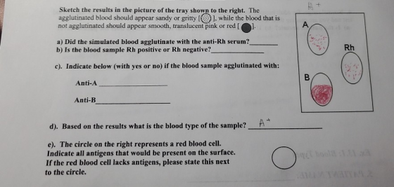 Sketch the results in the picture of the tray shown to the right. The agglutinated blood should appear sandy or gritty [ ], w