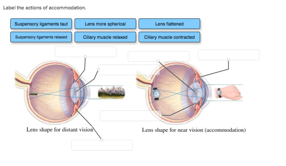 Label the actions of accommodation Suspensory ligaments taut Lens more spherical Lens flattened Suspensory ligaments relaxed Ciliary muscle relaxed Ciliary muscle contracted Lens shape for distant vision Lens shape for near vision (accommodation)