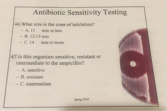Antibiotic Sensitivity Testing 46. What size is the zone of inhibition? A. 11 mm or less - B. 12-13 mm C. 14 mm or more 47.Is