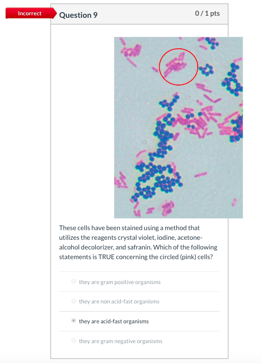 Incorrect Question 9 0/1 pts These cells have been stained using a method that utilizes the reagents crystal violet, iodine,