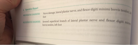 6Operative Report nerve and flexor digiti minimi brevi foot POS VE DIAGNOSIS: Severed superficial branch of lateral plantar n