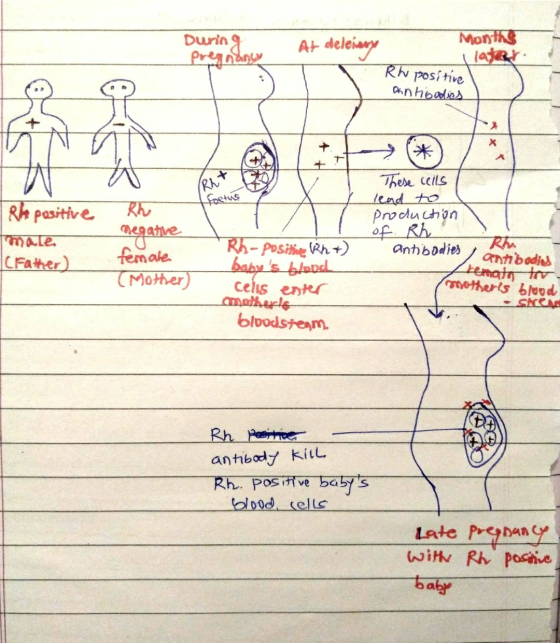 During Preana At deleiary Month i lasta RW positive antibodies Loetus Rh positive male (Father) Rh negative female (Mother) R