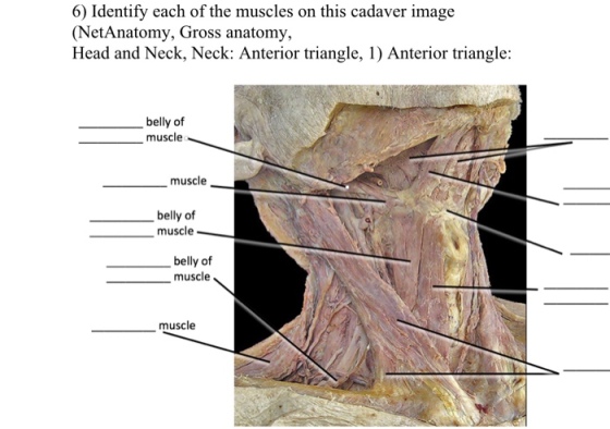 6) Identify each of the muscles on this cadaver image (NetAnatomy, Gross anatomy, Head and Neck, Neck: Anterior triangle, 1) Anterior triangle: belly of muscle muscle belly of muscle belly of muscle muscle