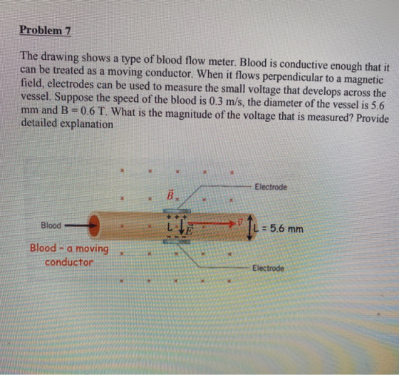 Problem 7 The drawing shows a type of blood flow meter. Blood is conductive enough that it can be treated as a moving conduct
