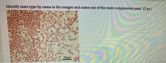 Identify stain type by name in the images and name one of the stain components used. (2 pt) 10um