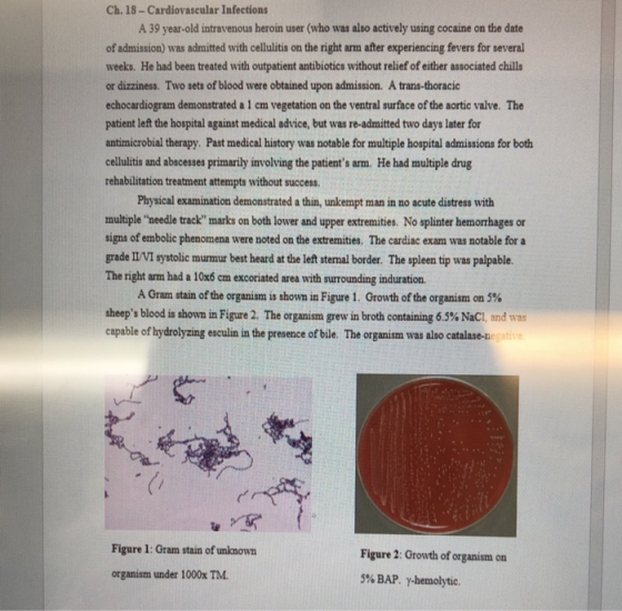 Ch. 18-Cardiovascular Infections A 39 year-old intravenous heroin user (who was also actively using cocaine on the date of ad