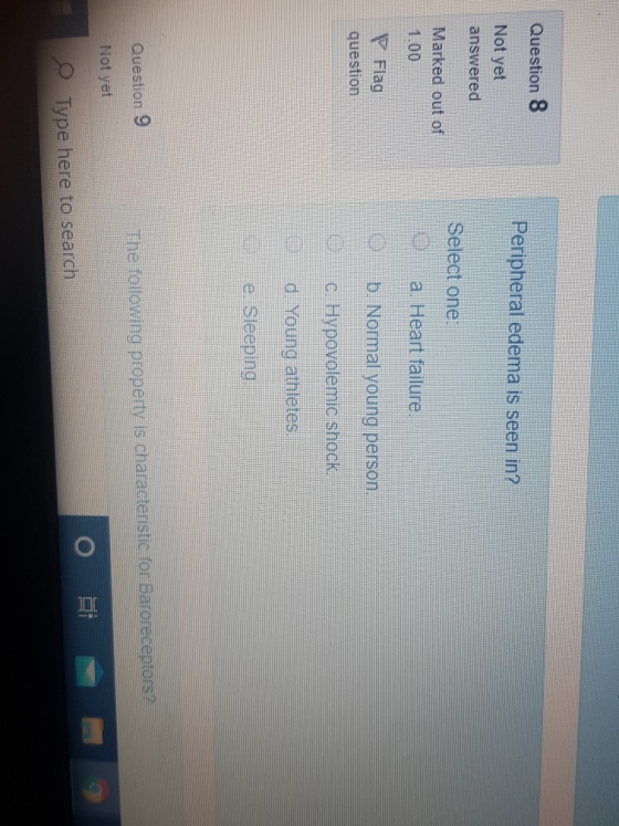 Question 8 Peripheral edema is seen in? Not yet answered Select one: Marked out of 1.00 a. Heart failure. P Flag question b.