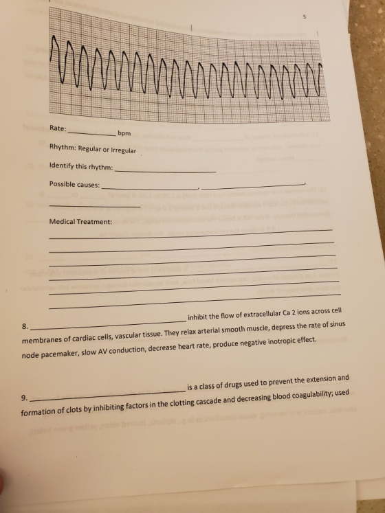 Rate: bpm Rhythm: Regular or Irregular . Regular or Irregular Identify this rhythm: Possible causes: Medical Treatment: inhi