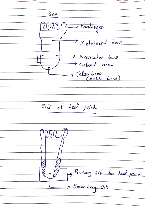 Phalanae Navicular-bore 0 (Ankla kone) Silz of heel prick prick ク-Secondary-Pit