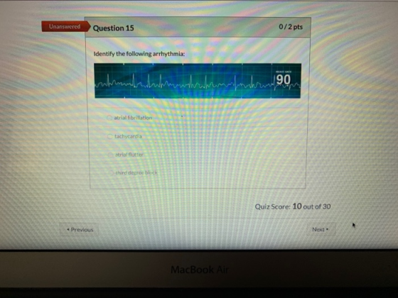 Unanswered Question 15 0/2 pts Identify the following arrhythmia: 90 M wrmmmhrwmum atrial fibrillation tachycardia trialflutt