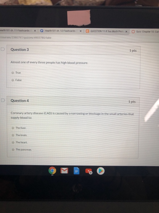 a 101 ch. 11 Flashcards * Q Health101 ch 12 Flashcards X C QUESTION 11 If Too Much Protx O Ouiz Chapter 10. Ca courses/238079