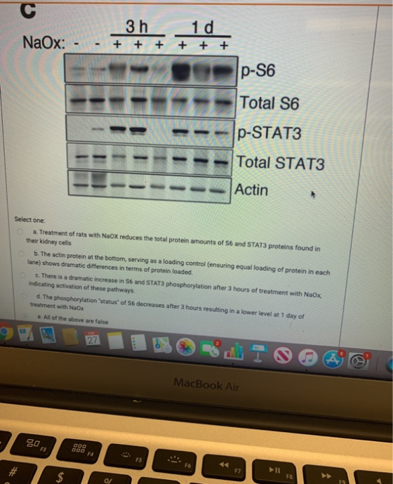 NaOx: | 3 h 1 d + + + + + - D p -S6 -------- Total S6 P-STAT3 Total STAT3 ----- Actin Select one Treatment of rats with NaOX