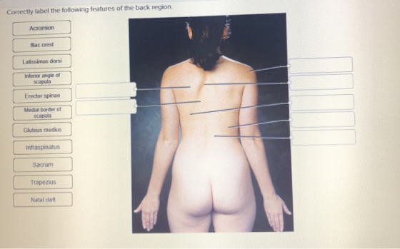 Correctly label the following features of the back region. Acromion Iliac crest Latissimus dorsi Inferior angle of scapula Er