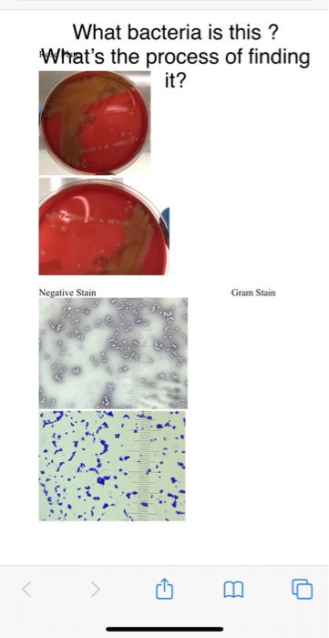 What bacteria is this? Whats the process of finding it? Negative Stain Gram Stain <