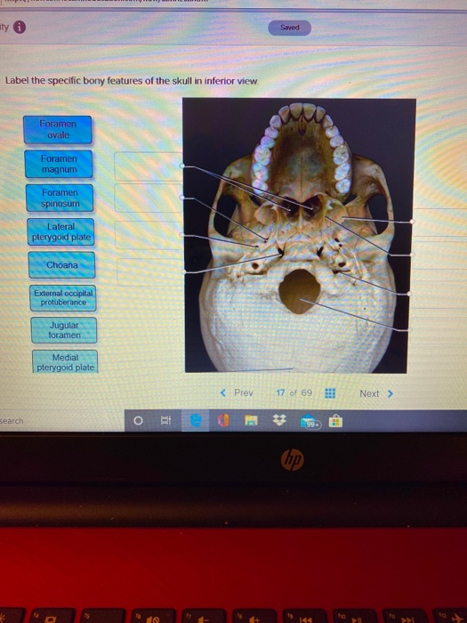 ty Label the specific bony features of the skull in inferior view. Formen ovale Foramen magnum Foramen spinosum Lateral plery