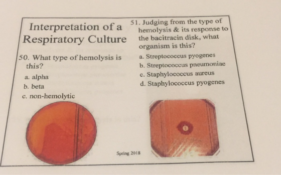 51. Judging from the type of terpretation ot a hemolysis oi disksw hemolysis & its response to the bacitracin disk, what orga