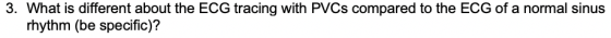 3. What is different about the ECG tracing with PVCs compared to the ECG of a normal sinus rhythm (be specific)?