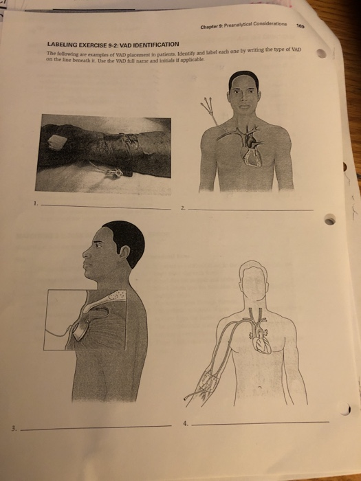 drions Chapter 9: Preanalytical Considerations 1 LABELING EXERCISE 9-2:VAD IDENTIFICATION are amples of VAD placement in pati