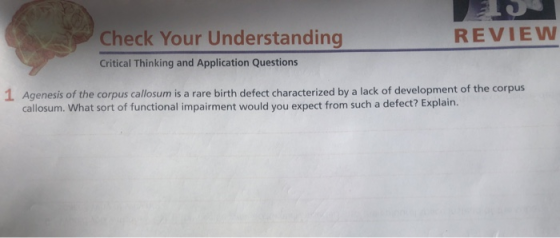 Check Your Understanding REVIEW Critical Thinking and Application Questions 1 Agenesis of the corpus callosum is a rare birth