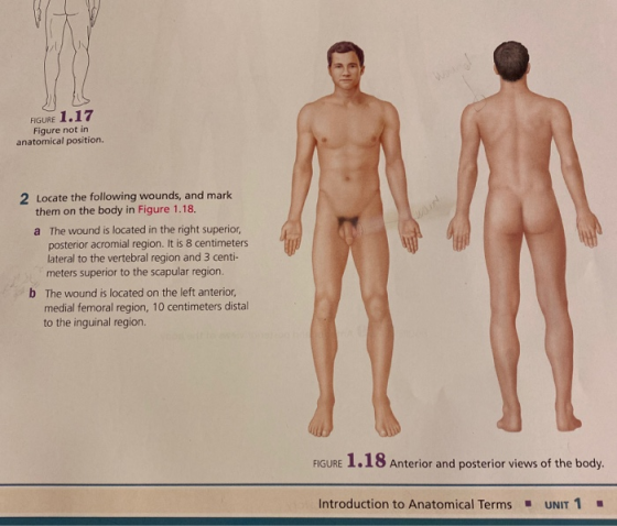 FIGURE 1.17 Figure not in anatomical position. 2 Locate the following wounds, and mark them on the body in Figure 1.18. a The